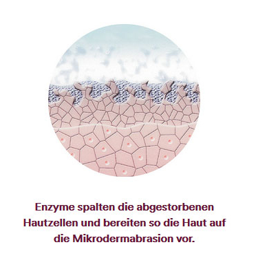 KOSAMA GmbH Ballwil - Microdermabrasion