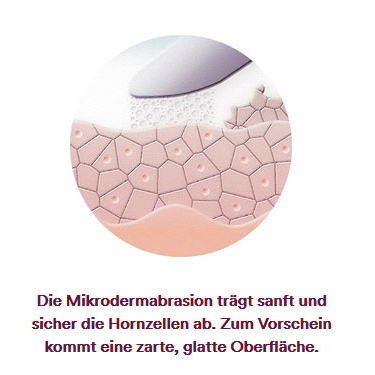KOSAMA GmbH Ballwil - Microdermabrasion