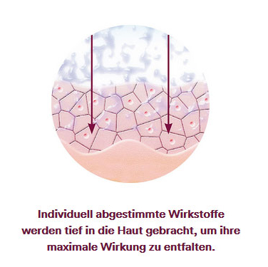 KOSAMA GmbH Ballwil - Microdermabrasion